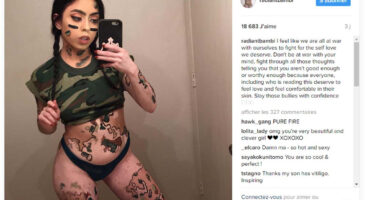 Atteinte de vitiligo, cette jeune femme transforme son corps en œuvre d’art