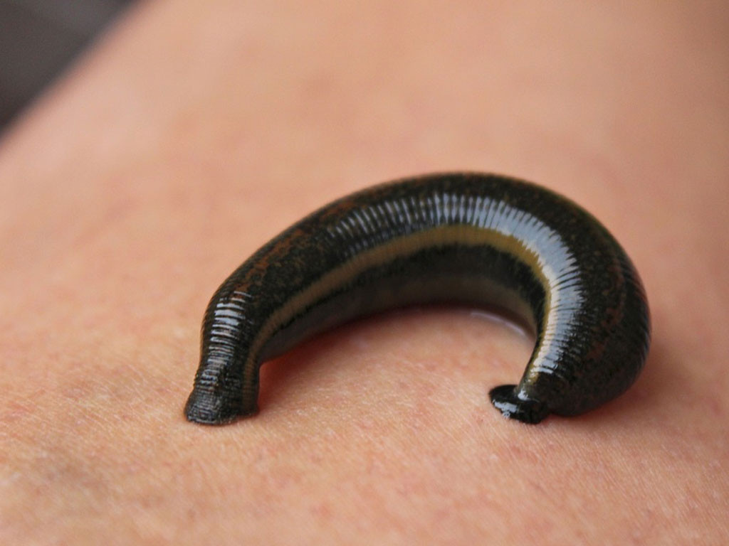 Une sangsue de 6cm retirée du corps d&rsquo;une petite fille de 6 ans