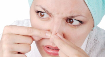 5 astuces pour dire adieu aux points noirs qui vous dérangent tant