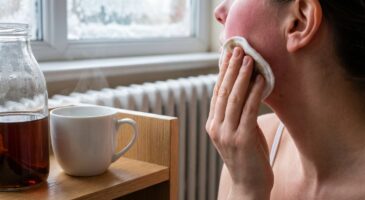 Peau qui tiraille en hiver : ce geste avec cette boisson du placard a tout changé sans dépenser 1 centime