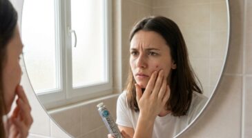 Acné : cette vieille astuce avec du dentifrice pourrait abîmer votre peau beaucoup plus que vous ne l’imaginez
