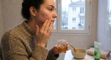 Éruption de boutons surprise : ce masque naturel minute remplace le dentifrice et laisse la peau nette en 48 h
