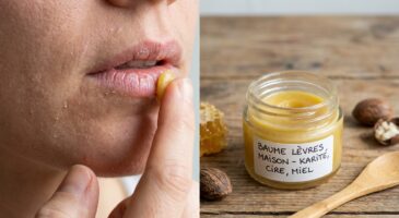 Lèvres gercées : voici le baume maison express prêt en 5 minutes qui fait oublier vos sticks bourrés de pétrochimie