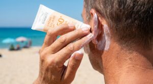 Cancer de la peau : cette petite zone du visage que presque tous les Français oublient de protéger chaque été