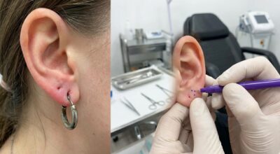 J’ai fait percer mes oreilles au mauvais endroit pendant des années : la vérité que m’a dite un perceur pro m’a glacée